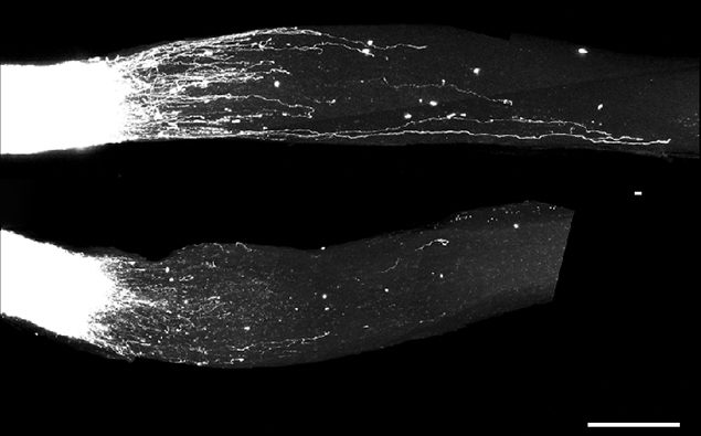 En haut : la surexpression des gènes de la famille B2-SINE dans les neurones ganglionnaires rétiniens a entraîné une croissance accélérée après une lésion. En bas : cellules ganglionnaires après une lésion sans surexpression de B2-SINE.
