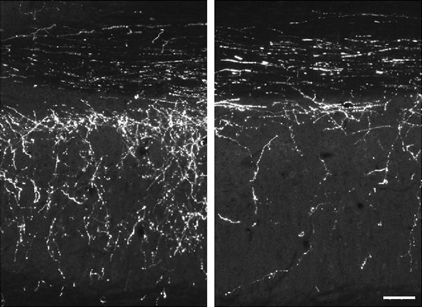 À gauche : dans les neurones du cortex moteur de souris, la surexpression des gènes de la famille B2-SINE a entraîné une accélération de la régénération cellulaire après une lésion. À droite : lésion dans les mêmes cellules sans surexpression de B2-SINE.
