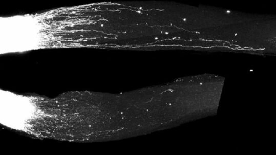 Les cellules nerveuses apprennent à se développer