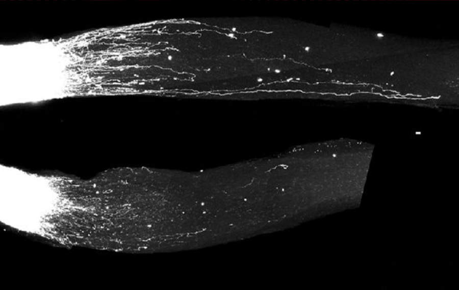 Les cellules nerveuses apprennent à se développer