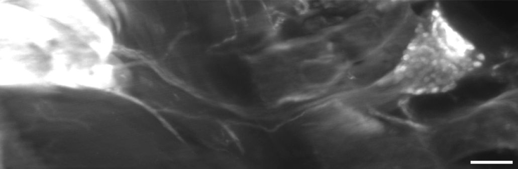 Les cellules nerveuses sensorielles révélées dans l'étude étendent leurs longues fibres depuis la colonne vertébrale de la souris (à droite) jusqu'aux tissus adipeux bruns (à gauche).