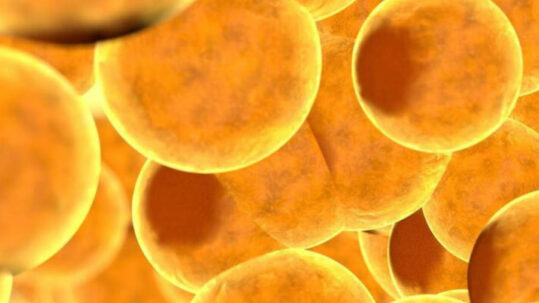 Détection des graisses