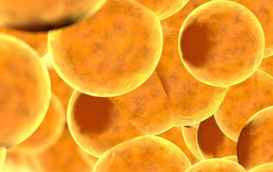 Détection des graisses