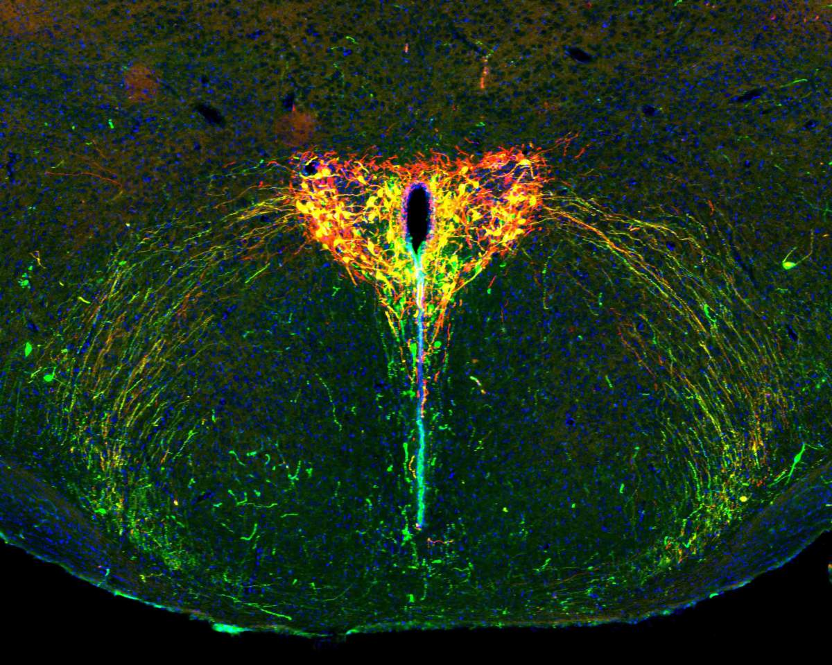Le cerveau en développement d'un souriceau âgé de deux semaines sous le microscope. Le système de l'ocytocine apparaît en vert, la protéine photosensible en rouge et les cellules qui contiennent les deux apparaissent en jaune. Les noyaux cellulaires sont en bleu.