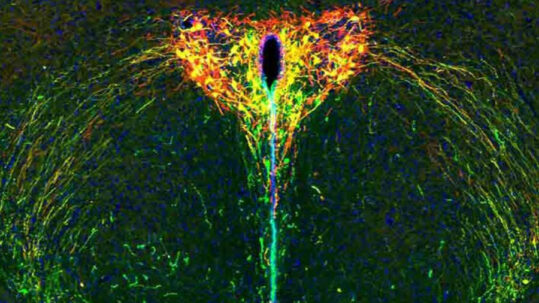 Mettre en lumière le développement du cerveau : comment la séparation parentale nous façonne