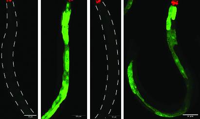 Les images de microscopie confocale de vers des deux sexes montrent une forte expression d'un gène immunitaire (vert) lors de l'exposition à une bactérie pathogène chez les femelles (deuxième à partir de la gauche) et les mâles (extrême droite). D'autres images montrent l'absence de réponse immunitaire après l'exposition à l'autre bactérie chez les femelles (extrême gauche) et les mâles (deuxième à partir de la droite). Les mâles n'ont pas tiré les leçons de l'expérience, même si leur réponse immunitaire à la bactérie nocive était identique à celle des femelles.