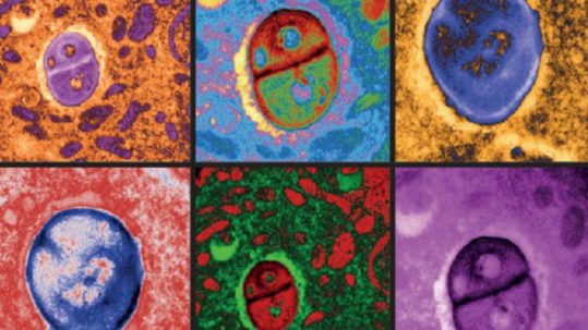 Images colorisées de microscopie électronique de cellules de mélanome abritant des bactéries