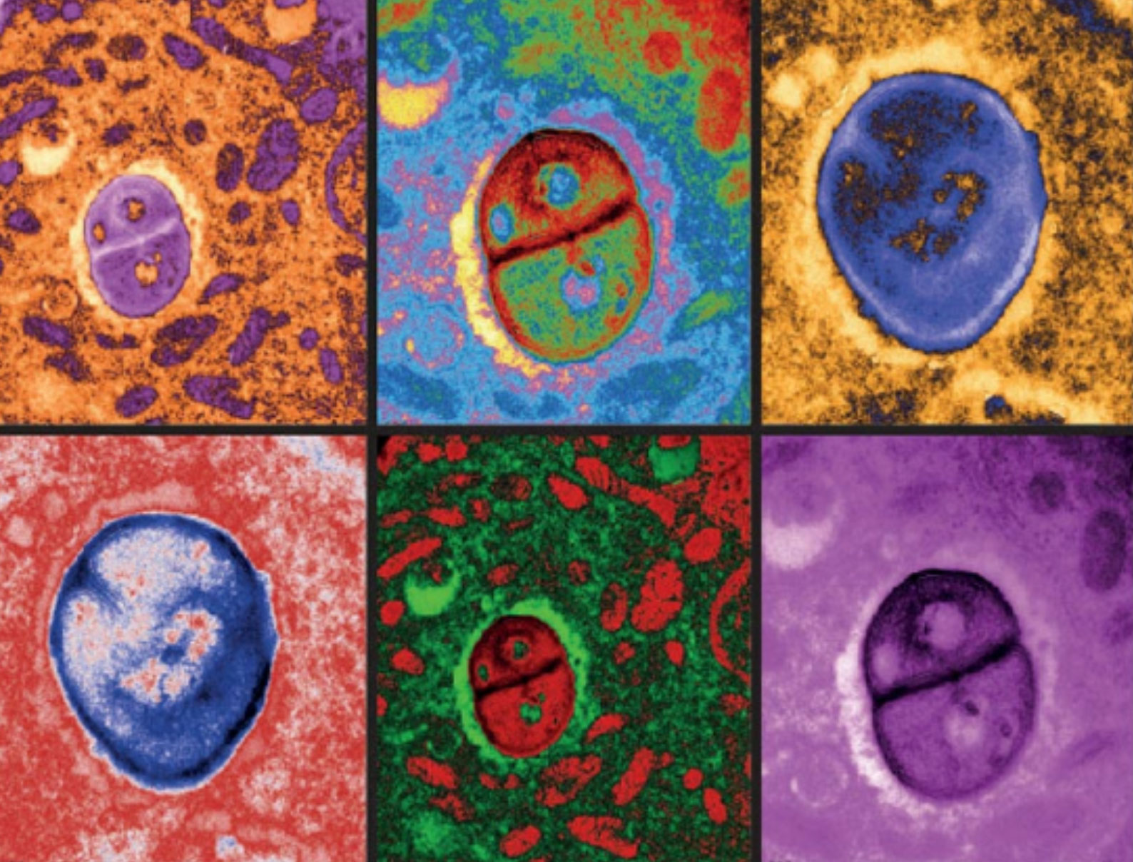 Images colorisées de microscopie électronique de cellules de mélanome abritant des bactéries
