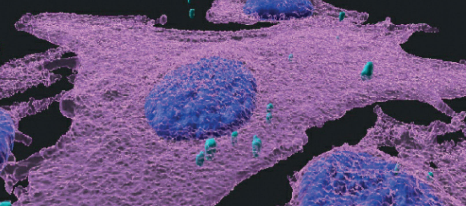 Image par immunofluorescence 3D de cellules de mélanome (magenta) infectées par des bactéries (turquoise). Les noyaux des cellules sont en bleu