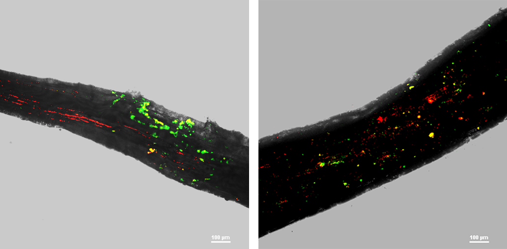 Les racines des arbres recrutent des bactéries bénéfiques pendant la sécheresse. L'imagerie par fluorescence et en champ clair révèle que pendant la sécheresse (à gauche), une racine d'arbre est plus densément colonisée par deux bactéries bénéfiques (en vert et en rouge) qu'après l'irrigation (à droite).