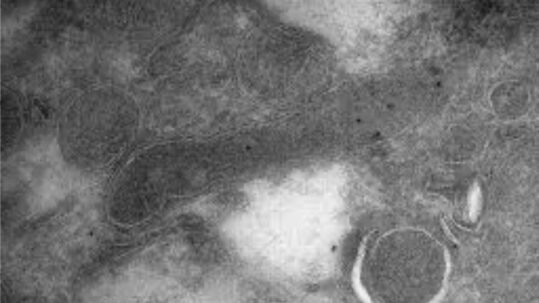 Des Bactéries dans le cerveau