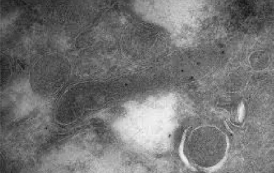 Des Bactéries dans le cerveau