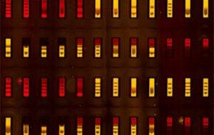 Image au microscope fluorescent de la biopuce avec ses nombreux compartiments minuscules, chacun présentant un antigène différent, ce qui permet de tester simultanément les interactions de tous ces antigènes avec un anticorps humain.