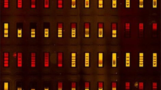 Image au microscope fluorescent de la biopuce avec ses nombreux compartiments minuscules, chacun présentant un antigène différent, ce qui permet de tester simultanément les interactions de tous ces antigènes avec un anticorps humain.