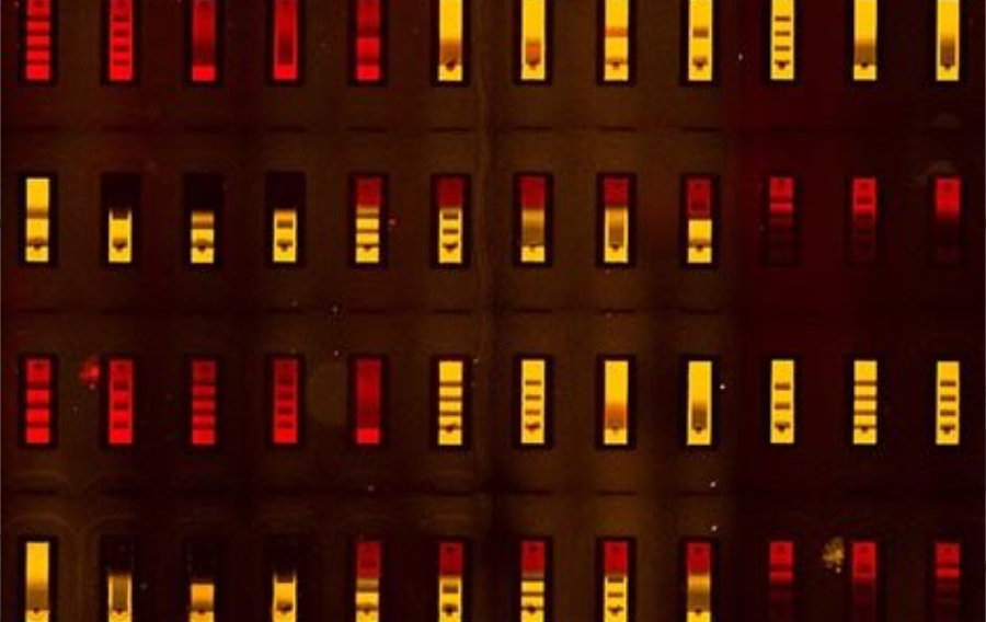 Image au microscope fluorescent de la biopuce avec ses nombreux compartiments minuscules, chacun présentant un antigène différent, ce qui permet de tester simultanément les interactions de tous ces antigènes avec un anticorps humain.