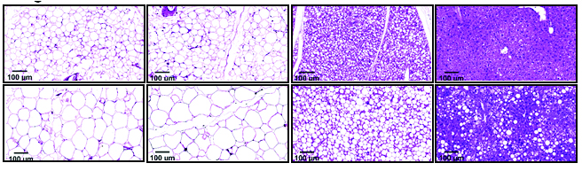 Échantillons de tissus d'une souris saine (rangée du haut) et d'une souris dépourvue du gène SARAF (rangée du bas). Les souris dépourvues du gène présentaient (de gauche à droite) plus de graisse au niveau de l'aine et autour des organes internes, moins de graisse brune et des signes de stéatose hépatique.
