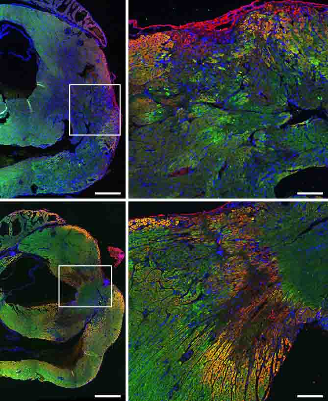 Coupes cardiaques de souris après une blessure simulant une crise cardiaque. 