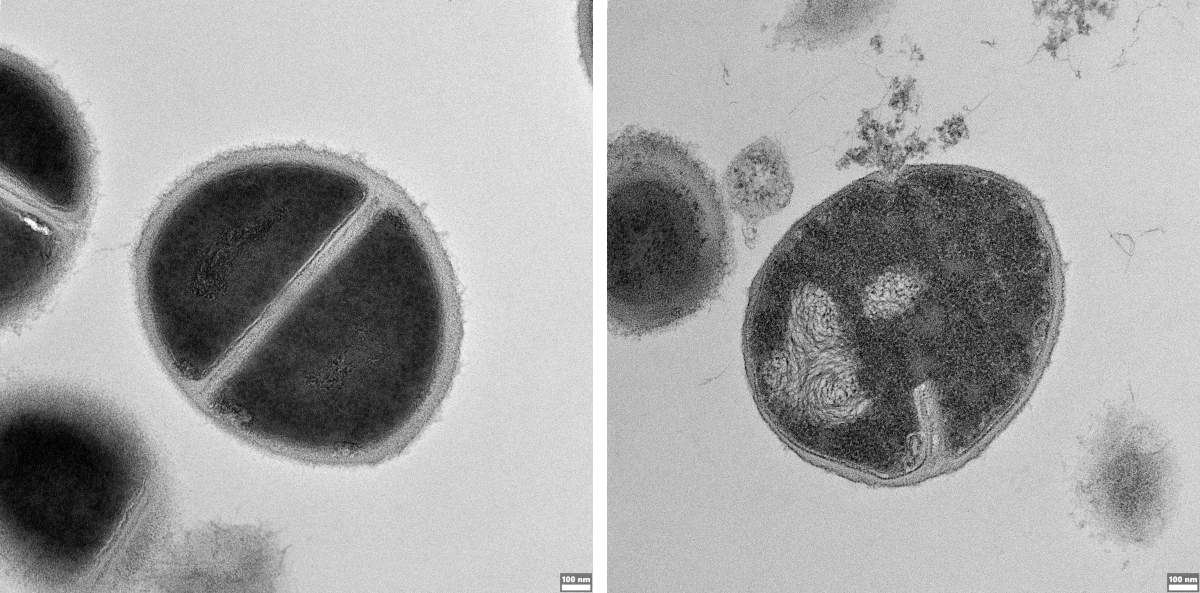 Bactérie Staphylococcus pouvant provoquer des infections humaines conduisant à une défaillance immunitaire. 