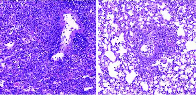 Le tissu pulmonaire d'une souris diabétique (à droite) contient moins de cellules immunitaires (petits points violets) que celui d'un animal non diabétique (à gauche).
