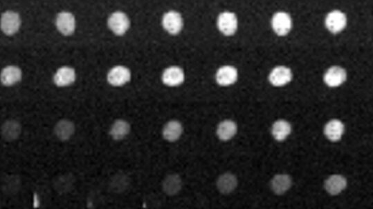 Une nouvelle étude révèle que les hormones sexuelles réinitialisent notre horloge biologique