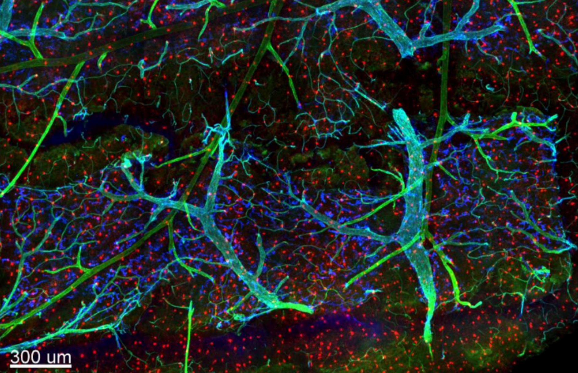 Les méninges et les tissus profonds dans le cerveau d’une souris