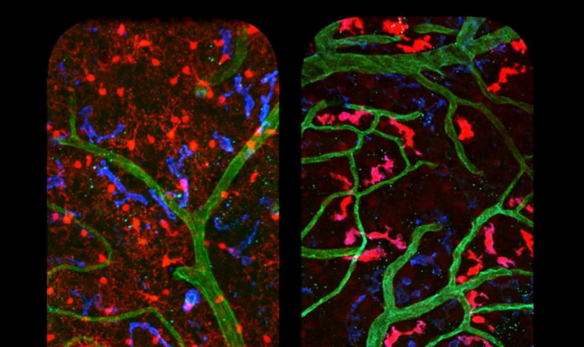 En rouge, la microglie (à gauche) et les macrophages périvasculaires (à droite) ont des formes et des localisations différentes