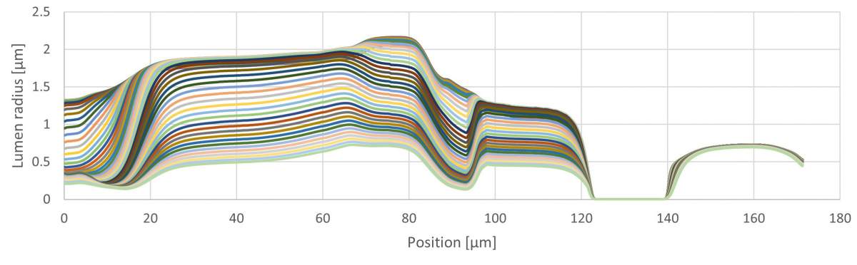 Graphique montrant les changements qui ont lieu dans le lumen, l'espace creux à l'intérieur du tube digestif du ver, au cours du processus d'alimentation simulé. 