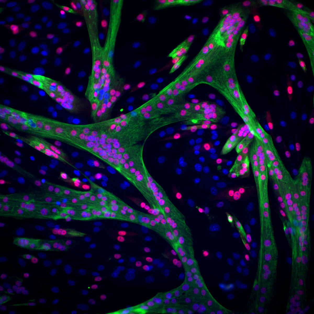 La construction des muscles : Les cellules souches musculaires (dont les noyaux sont marqués en bleu) modifient progressivement leur structure et leur fonction pour devenir des cellules musculaires adultes (dont les noyaux deviennent rouges). 