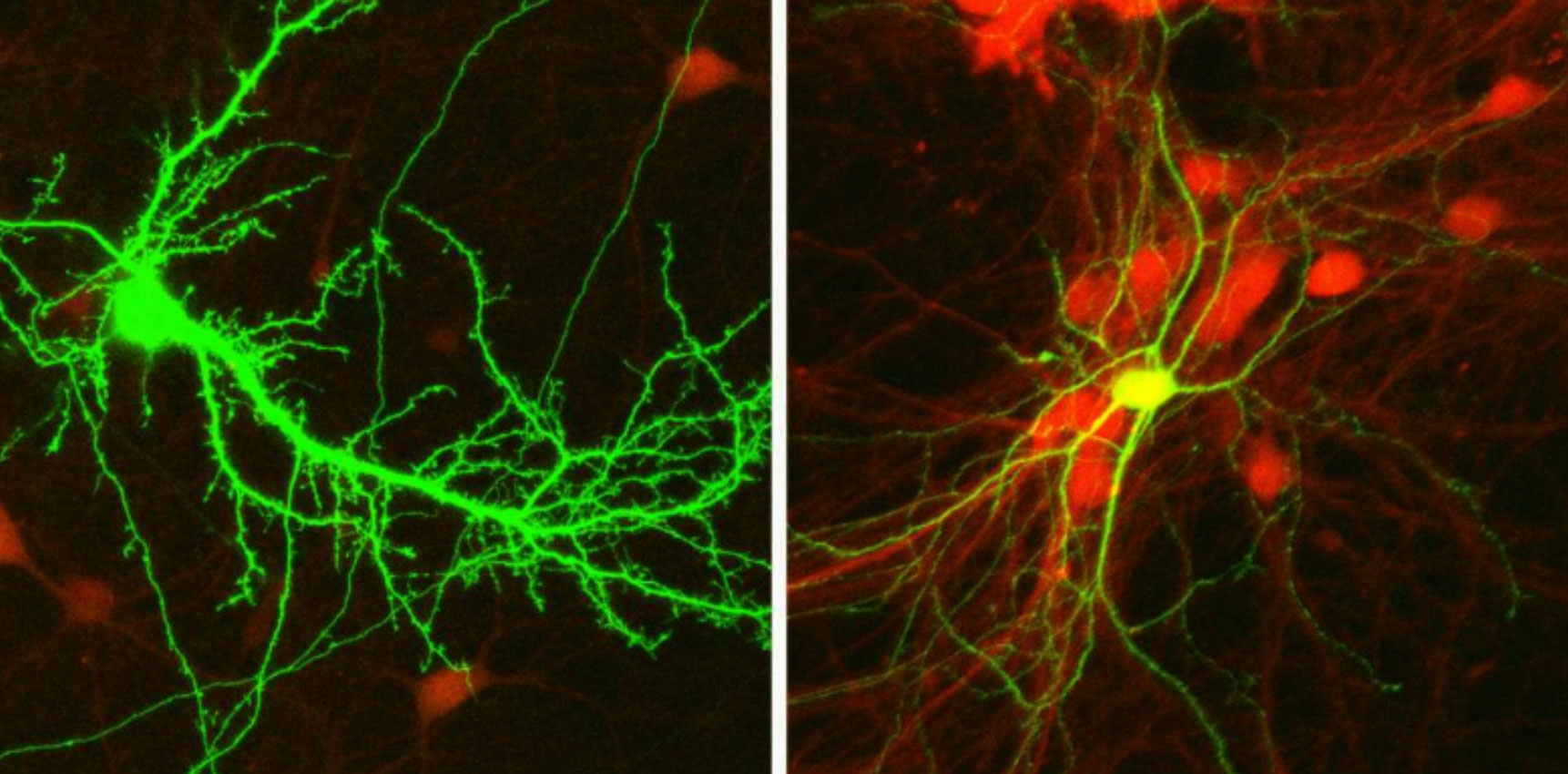 Des neurones de souris – excitateurs (à gauche) et inhibiteurs (à droite) – vus sous un microscope