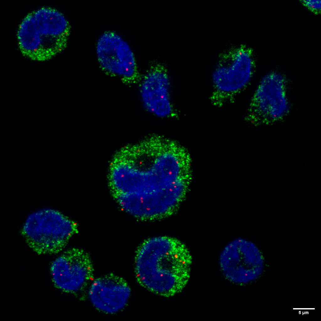 Alerte rouge, fausses pistes : molécules d'ARN du paludisme (points rouges) observées à l'intérieur des noyaux (bleu) de monocytes (vert) à l'aide d'un microscope confocal à fluorescence
