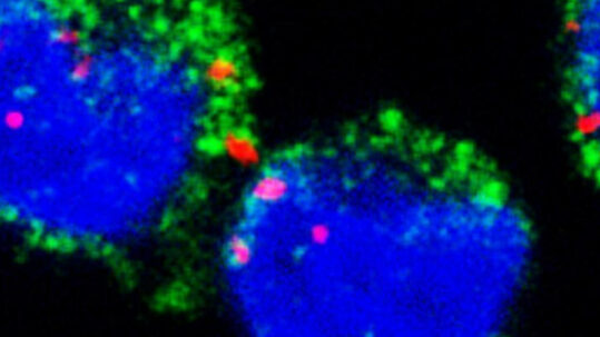 ARNm du paludisme : des messages qui perturbent le système immunitaire