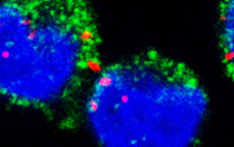 ARNm du paludisme : des messages qui perturbent le système immunitaire