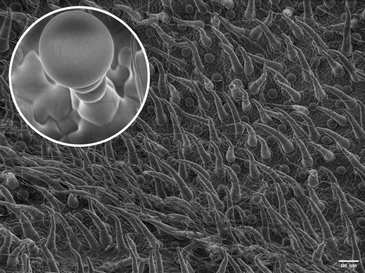 On a découvert que les cannabinoïdes sont produits dans le parapluie laineux à l'intérieur de minuscules structures appelées trichomes, qui ont la forme de ballons sur une tige, observés ici au cryo-microscope électronique à balayage.
