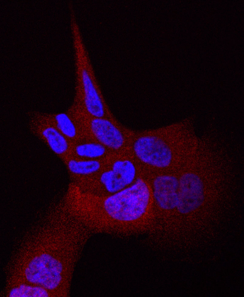 Cellules de cancer du poumon humain présentant la mutation L858R du gène EGFR. Les noyaux cellulaires sont en bleu. La couleur rouge indique la présence d'une protéine dans le cytoplasme de la cellule lorsque l'EGFR est actif et entraîne des divisions cellulaires incontrôlées.