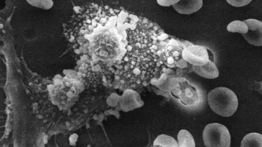 Macrophages tuant une cellule cancéreuse. Photo de Susan Arnold et Raowf Guirguis / National Cancer Institute