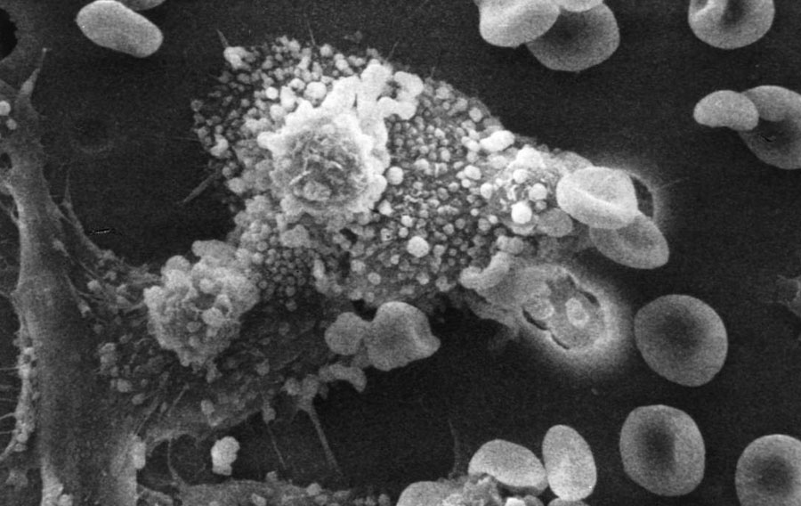 Macrophages tuant une cellule cancéreuse. Photo de Susan Arnold et Raowf Guirguis / National Cancer Institute