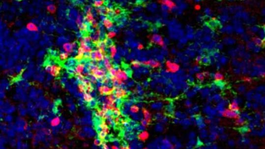 Le cerveau d'une souris atteinte d'une maladie semblable à la SEP révèle des groupes de microglies (en vert) et de cellules T (en rouge). À gauche : vue générale ; à droite : zoom avant