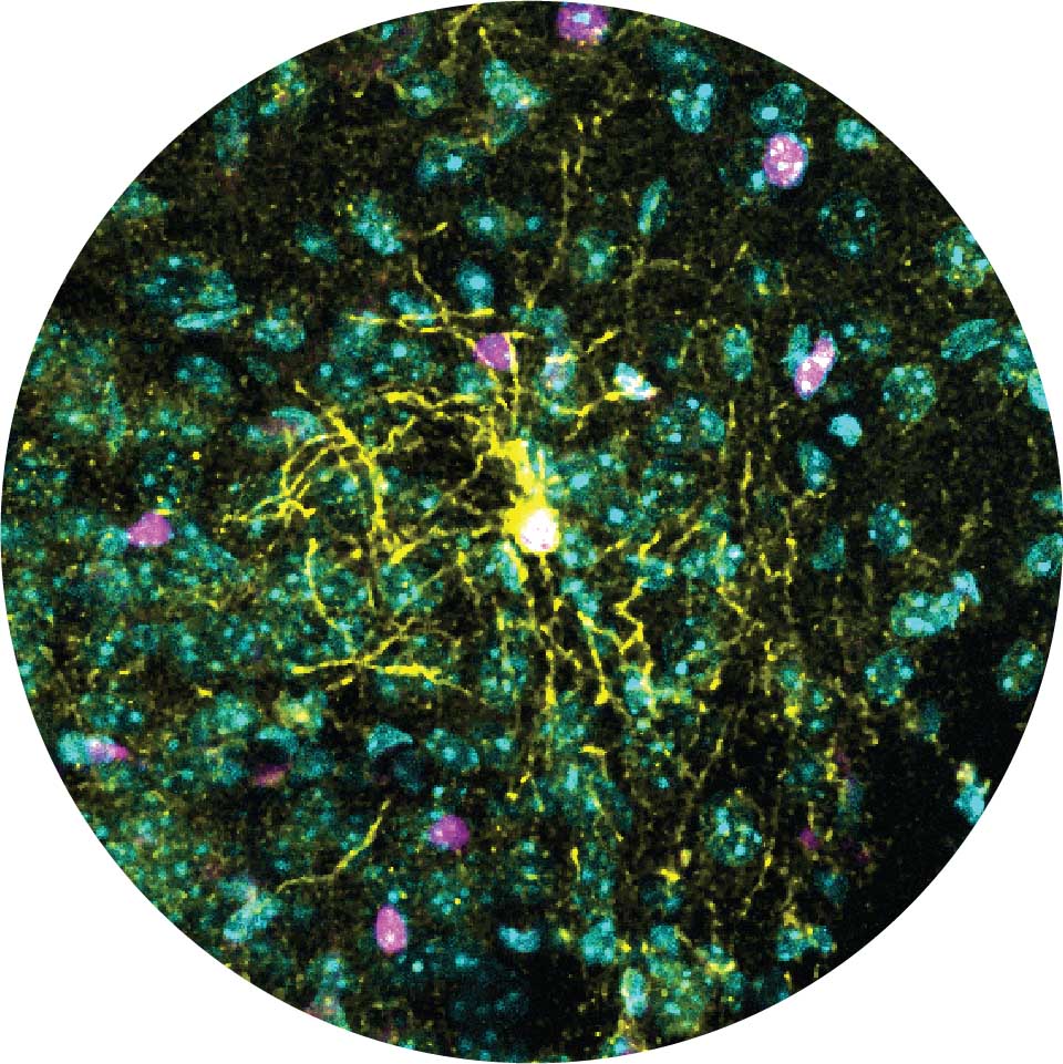 Coupe d'un cerveau de souris au microscope. La couleur jaune montre la structure complexe d'un oligodendrocyte mature, avec de nombreuses branches qui s'étendent vers les cellules environnantes.
