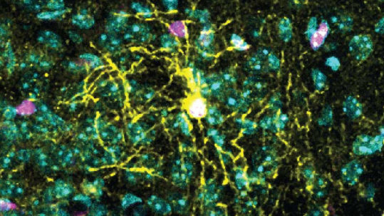 Vive la différence : Les cellules cérébrales des hommes et des femmes réagissent différemment au stress chronique