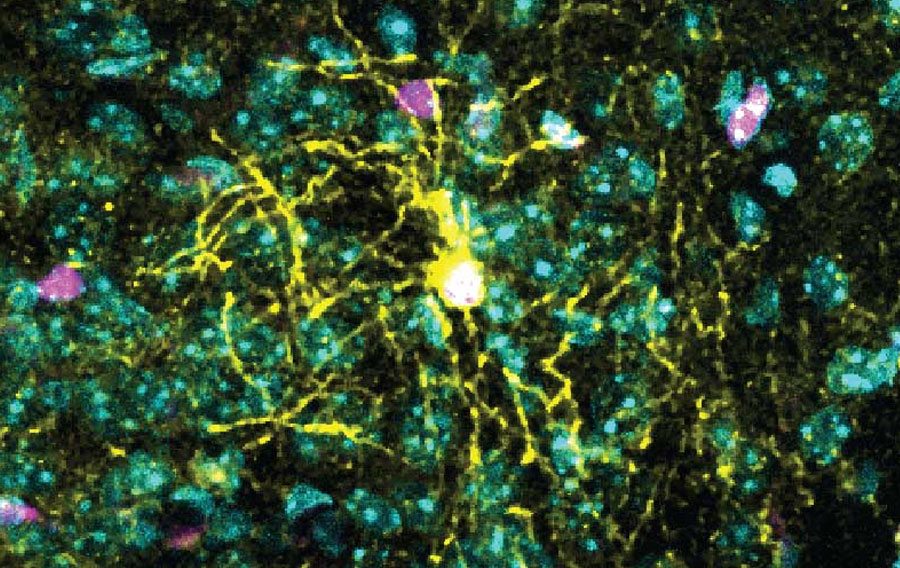 Vive la différence : Les cellules cérébrales des hommes et des femmes réagissent différemment au stress chronique