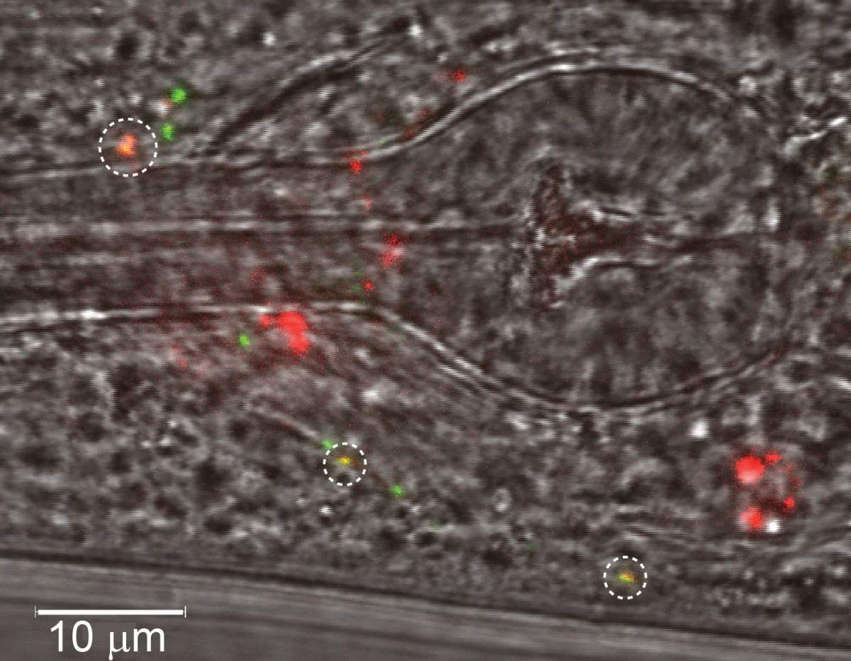 Partie de la tête d'un ver mâle sous un microscope, les synapses ajoutées artificiellement étant marquées par des cercles.