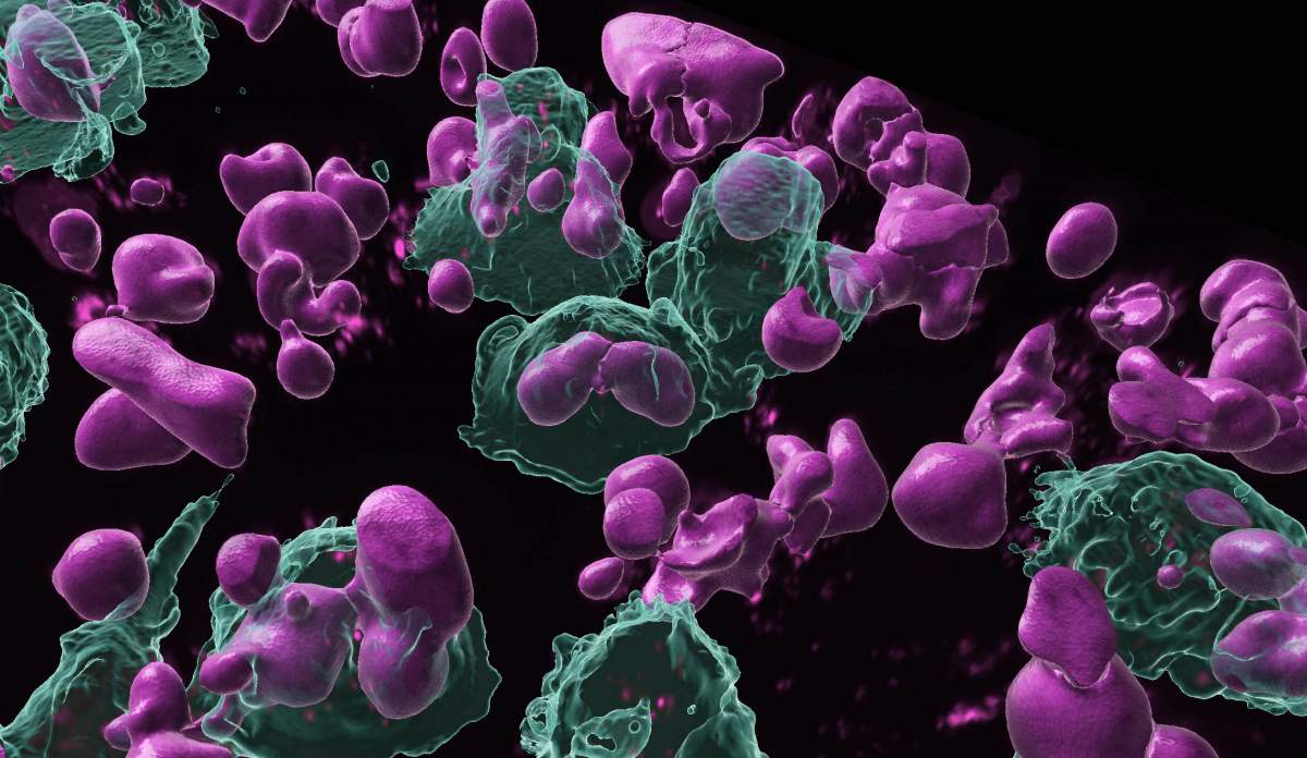Les cellules phagocytaires (en vert) phagocytent les lymphocytes B activés (en rose), ce qui inhibe la réponse immunitaire locale. Les cellules ont été observées en trois dimensions à l'aide d'un microscope confocal. 