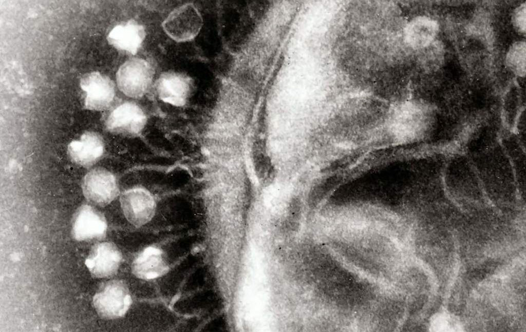 Bacteriophages attaquant une bactérie. Source: Prof. Graham Beards