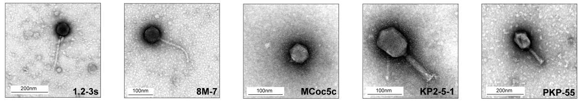 combattre les bactéries avec des virus spécialisés