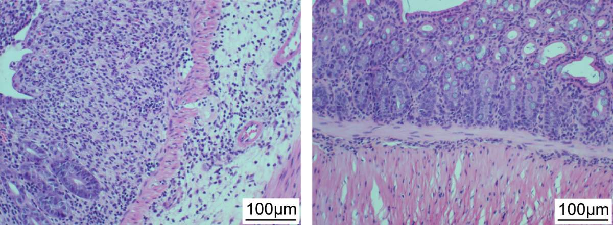 Paroi intestinale d’une souris endommagée quand exposée à des souches causant une inflammation (gauche). La détérioration est atténuée quand la souris a reçu un cocktail de cinq phages ciblant ces souches bactériennes (droite) 